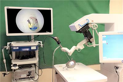 Robot-Assisted Middle Ear Endoscopic Surgery: Preliminary Results on 37 Patients